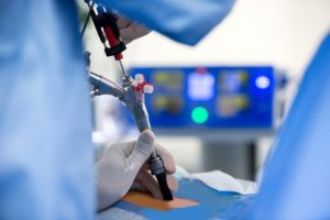 В хирургическом отделении больницы начато выполнение эндоскопических операций пациентам с грыжами пищеводного отверстия диафрагмы.